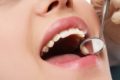 Weiße Zähne durch Kohle? Schwarze Zahnpasta mit Aktivkohle ist der neueste Trend im Kampf gegen verfärbte Zähne.