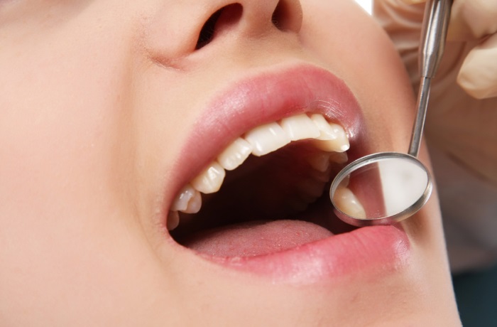 Weiße Zähne durch Kohle? Schwarze Zahnpasta mit Aktivkohle  ist der neueste Trend im Kampf gegen verfärbte Zähne.